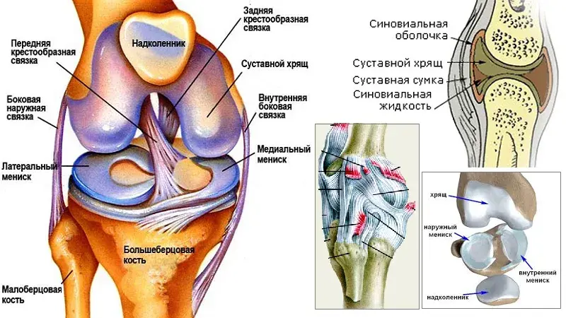 Анатомическая схема коленного сустава с признаками артроза