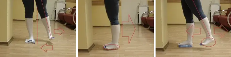Перенос веса и шаги в сторону после эндопротезирования